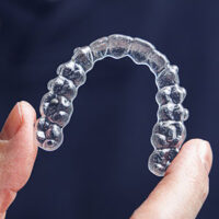 invisalign